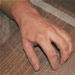 Skin effect on hands